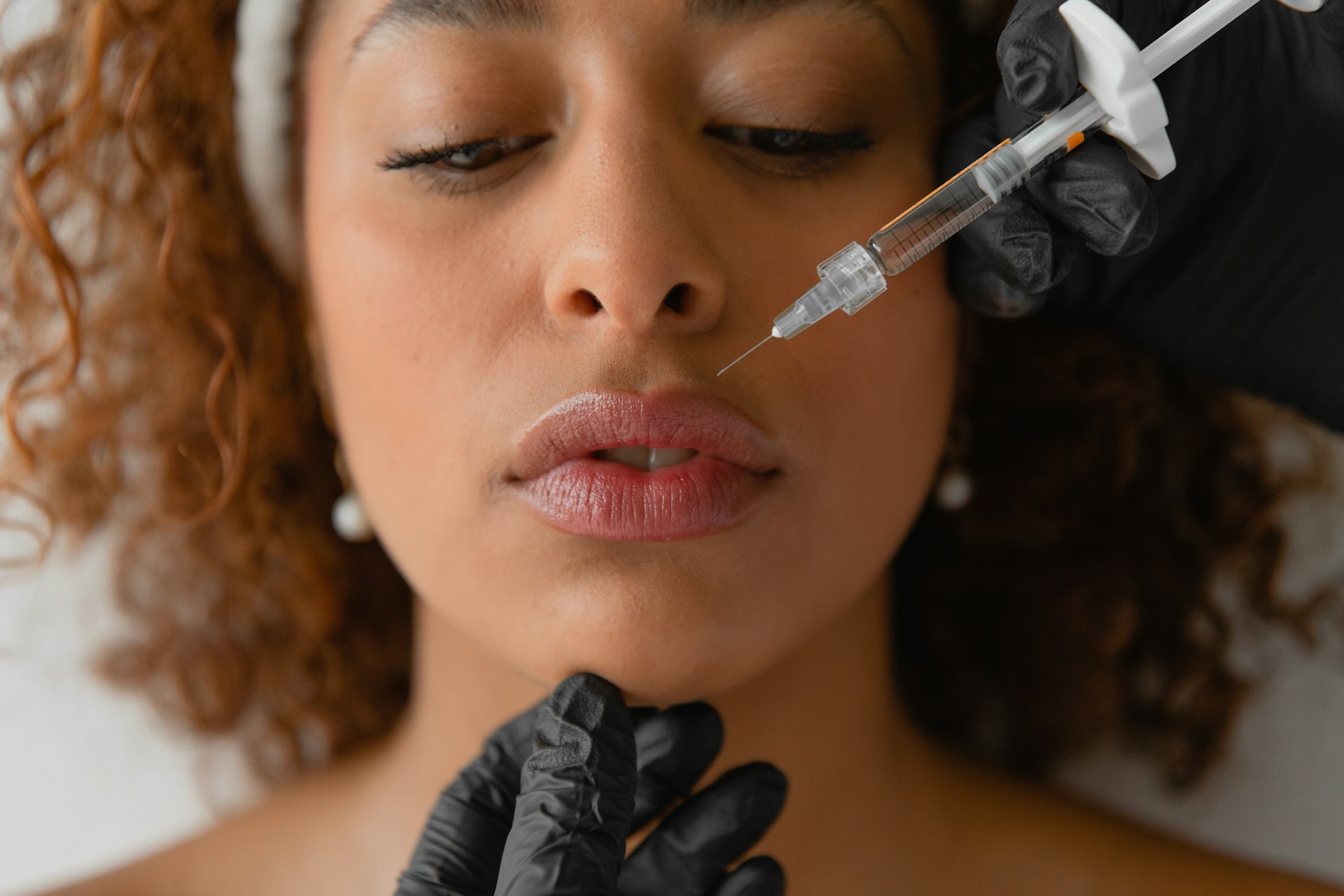 lip filler